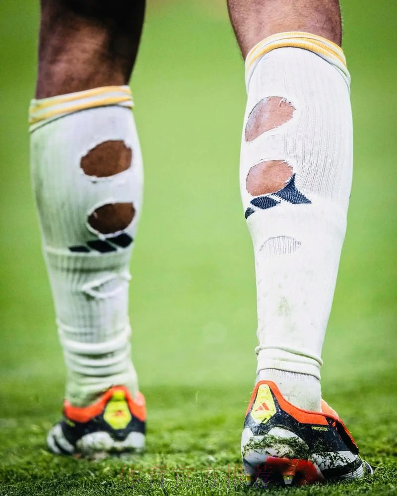 贝林穿破洞球袜属于违规 但因健康因素放宽限制